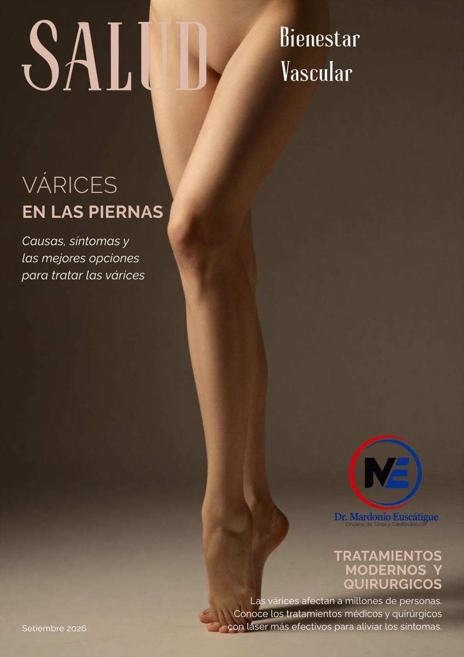 Afiche de salud vascular con una fotografía de piernas e información sobre várices.